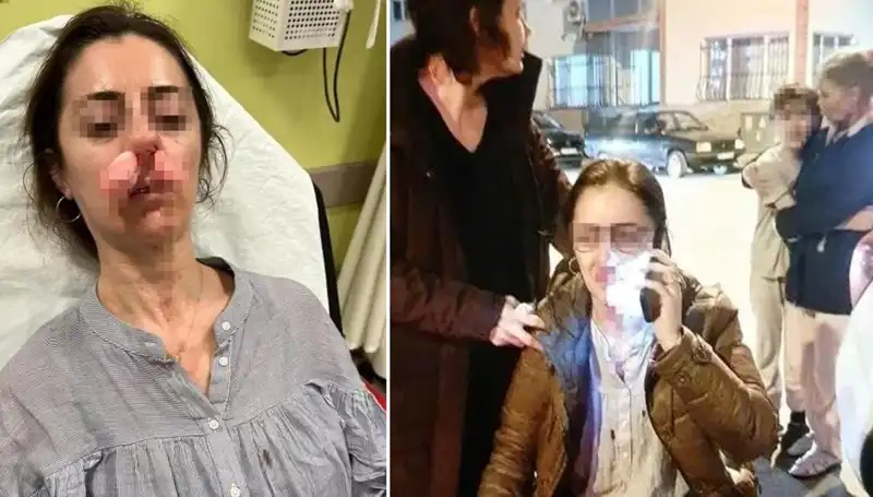 Eşinin Sevgilisi Sandığı Adamı Araba Kapısıyla Vurdu!